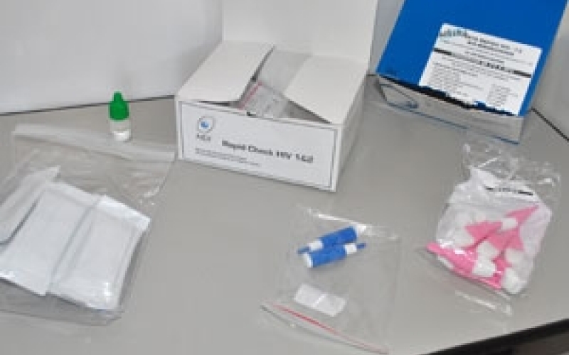 Jacarezinho realiza campanha do teste rápido de HIV durante a semana