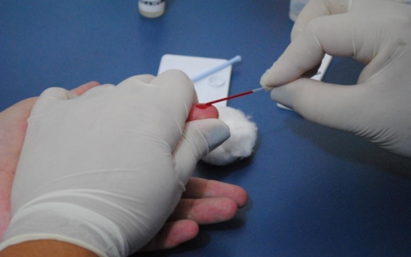 Vigilância Epidemiológica intensifica testes rápidos de AIDS em Jacarezinho